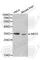 Sirtuin 5 antibody, A5784, ABclonal Technology, Western Blot image 