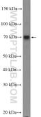 Melanoma-associated antigen C3 antibody, 21491-1-AP, Proteintech Group, Western Blot image 