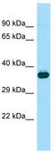 Wnt Family Member 8B antibody, TA334009, Origene, Western Blot image 