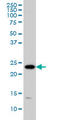 Proteasome 26S Subunit, Non-ATPase 10 antibody, LS-B10019, Lifespan Biosciences, Western Blot image 