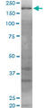 WRN RecQ Like Helicase antibody, LS-C198442, Lifespan Biosciences, Western Blot image 