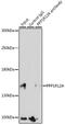 Mbs antibody, 13-210, ProSci, Immunoprecipitation image 