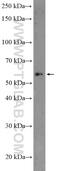 Gliomedin antibody, 26185-1-AP, Proteintech Group, Western Blot image 