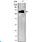 Zinc Finger And BTB Domain Containing 7B antibody, LS-C812789, Lifespan Biosciences, Western Blot image 