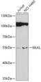 Mixed Lineage Kinase Domain Like Pseudokinase antibody, GTX66191, GeneTex, Western Blot image 