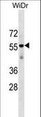 Glycerol-3-phosphate acyltransferase 3 antibody, LS-C161020, Lifespan Biosciences, Western Blot image 