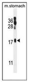 ORMDL Sphingolipid Biosynthesis Regulator 2 antibody, AP53121PU-N, Origene, Western Blot image 