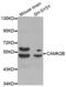 Calcium/Calmodulin Dependent Protein Kinase II Beta antibody, abx001950, Abbexa, Western Blot image 