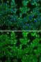 Methylthioadenosine Phosphorylase antibody, GTX54291, GeneTex, Immunofluorescence image 