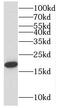 Folate Hydrolase 1 antibody, FNab06956, FineTest, Western Blot image 