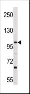 L3MBTL Histone Methyl-Lysine Binding Protein 3 antibody, LS-C203857, Lifespan Biosciences, Western Blot image 
