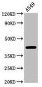 Carbohydrate Sulfotransferase 14 antibody, CSB-PA839851LA01HU, Cusabio, Western Blot image 