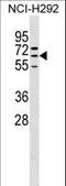 Zinc Finger Protein 599 antibody, LS-C157480, Lifespan Biosciences, Western Blot image 