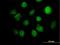 Inositol-tetrakisphosphate 1-kinase antibody, H00003705-B01P, Novus Biologicals, Immunofluorescence image 