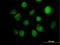 Inositol-Tetrakisphosphate 1-Kinase antibody, H00003705-B01P, Novus Biologicals, Immunofluorescence image 