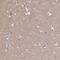 GCSFR antibody, PA5-61646, Invitrogen Antibodies, Immunohistochemistry paraffin image 