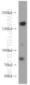 DNA Topoisomerase II Alpha antibody, 20233-1-AP, Proteintech Group, Western Blot image 