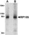 CD180 antigen antibody, MBS151079, MyBioSource, Western Blot image 