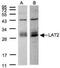 Linker For Activation Of T Cells Family Member 2 antibody, NBP1-31177, Novus Biologicals, Western Blot image 