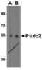 Plexin Domain Containing 2 antibody, 4417, ProSci, Western Blot image 