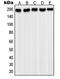 Platelet Derived Growth Factor Receptor Alpha antibody, LS-C352658, Lifespan Biosciences, Western Blot image 