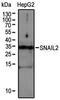 Snail Family Transcriptional Repressor 2 antibody, NBP2-27182, Novus Biologicals, Western Blot image 