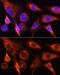 PSA antibody, GTX33434, GeneTex, Immunofluorescence image 