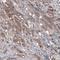 B-Raf Proto-Oncogene, Serine/Threonine Kinase antibody, NBP2-59035, Novus Biologicals, Immunohistochemistry frozen image 