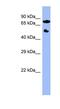 Cytochrome P450 Family 11 Subfamily B Member 2 antibody, NBP1-56518, Novus Biologicals, Western Blot image 