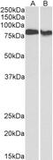 CREB Regulated Transcription Coactivator 2 antibody, 43-309, ProSci, Western Blot image 