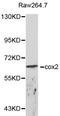 Calumenin antibody, LS-C192666, Lifespan Biosciences, Western Blot image 