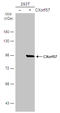 RPA1 Related Single Stranded DNA Binding Protein, X-Linked antibody, GTX120687, GeneTex, Western Blot image 