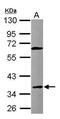 Fc Fragment Of IgE Receptor II antibody, PA5-27523, Invitrogen Antibodies, Western Blot image 