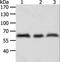 Tyrosinase antibody, LS-B15796, Lifespan Biosciences, Western Blot image 