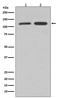 Vinculin antibody, M01207, Boster Biological Technology, Western Blot image 