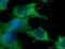 Charged Multivesicular Body Protein 4B antibody, 13683-1-AP, Proteintech Group, Immunofluorescence image 