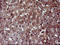 Mitogen-Activated Protein Kinase Kinase 1 antibody, LS-C787988, Lifespan Biosciences, Immunohistochemistry paraffin image 