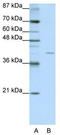 Eukaryotic Translation Initiation Factor 3 Subunit G antibody, TA345853, Origene, Western Blot image 