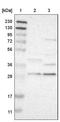 SRP Receptor Subunit Beta antibody, NBP1-89035, Novus Biologicals, Western Blot image 