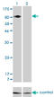 Integrin Subunit Beta 5 antibody, LS-C197557, Lifespan Biosciences, Western Blot image 