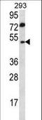 Abhydrolase Domain Containing 2 antibody, LS-C155870, Lifespan Biosciences, Western Blot image 