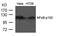 Nuclear Factor Kappa B Subunit 2 antibody, A01228-1, Boster Biological Technology, Western Blot image 