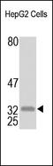 Voltage Dependent Anion Channel 1 antibody, 251931, Abbiotec, Western Blot image 