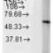 Heat Shock Protein Family D (Hsp60) Member 1 antibody, 11101, QED Bioscience, Western Blot image 