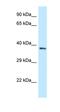 NADH:Ubiquinone Oxidoreductase Core Subunit S8 antibody, orb331153, Biorbyt, Western Blot image 