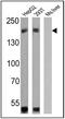ATP Binding Cassette Subfamily B Member 1 antibody, MA5-13854, Invitrogen Antibodies, Western Blot image 