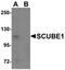 Signal Peptide, CUB Domain And EGF Like Domain Containing 1 antibody, orb75458, Biorbyt, Western Blot image 