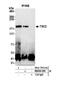 TSC Complex Subunit 2 antibody, NB200-200, Novus Biologicals, Western Blot image 