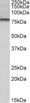 Dual Specificity Tyrosine Phosphorylation Regulated Kinase 1A antibody, STJ72785, St John