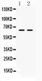 Heterogeneous Nuclear Ribonucleoprotein L antibody, A03769, Boster Biological Technology, Western Blot image 